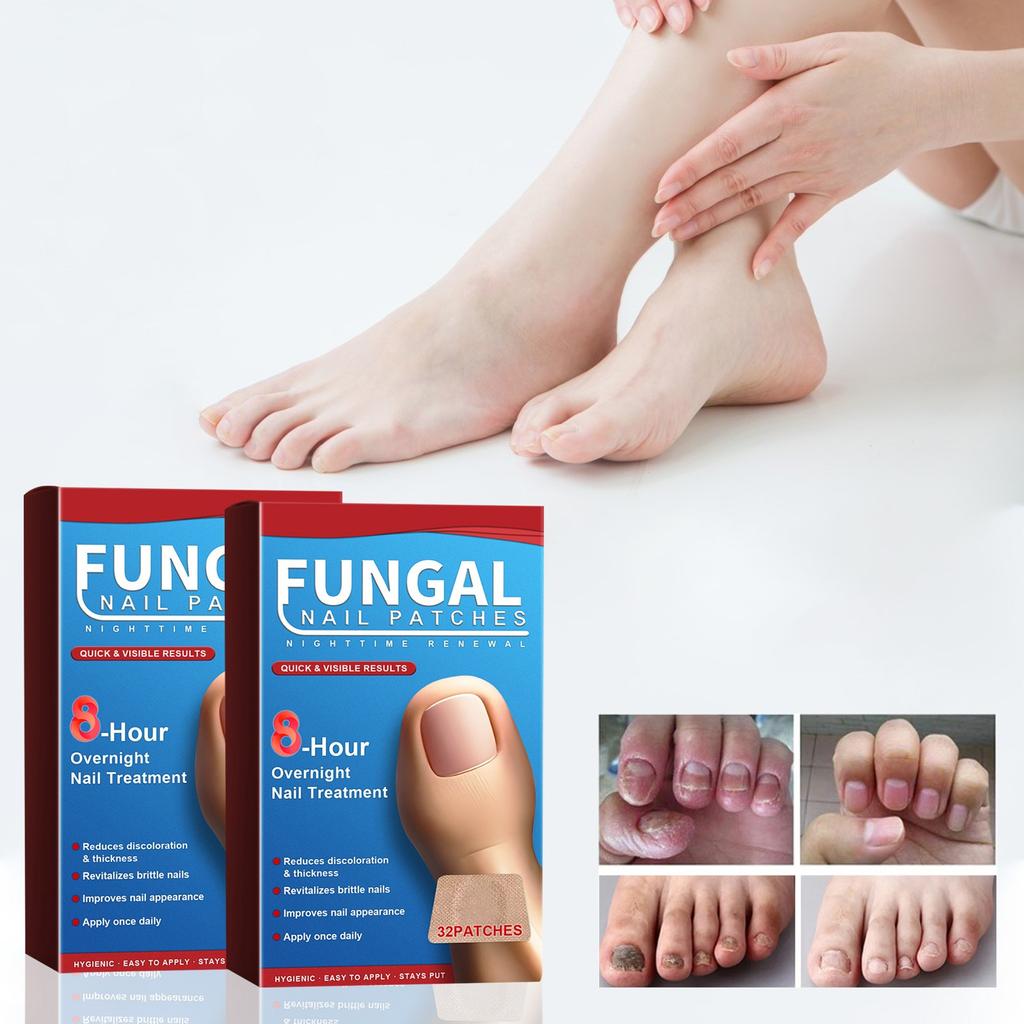 Adesivos para cuidados noturnos com as unhas Adesivos para cuidados com as unhas Cuidados com as unhas Unhas espessas Unhas encravadas e unhas moles Adesivos para cuidados com as unhas