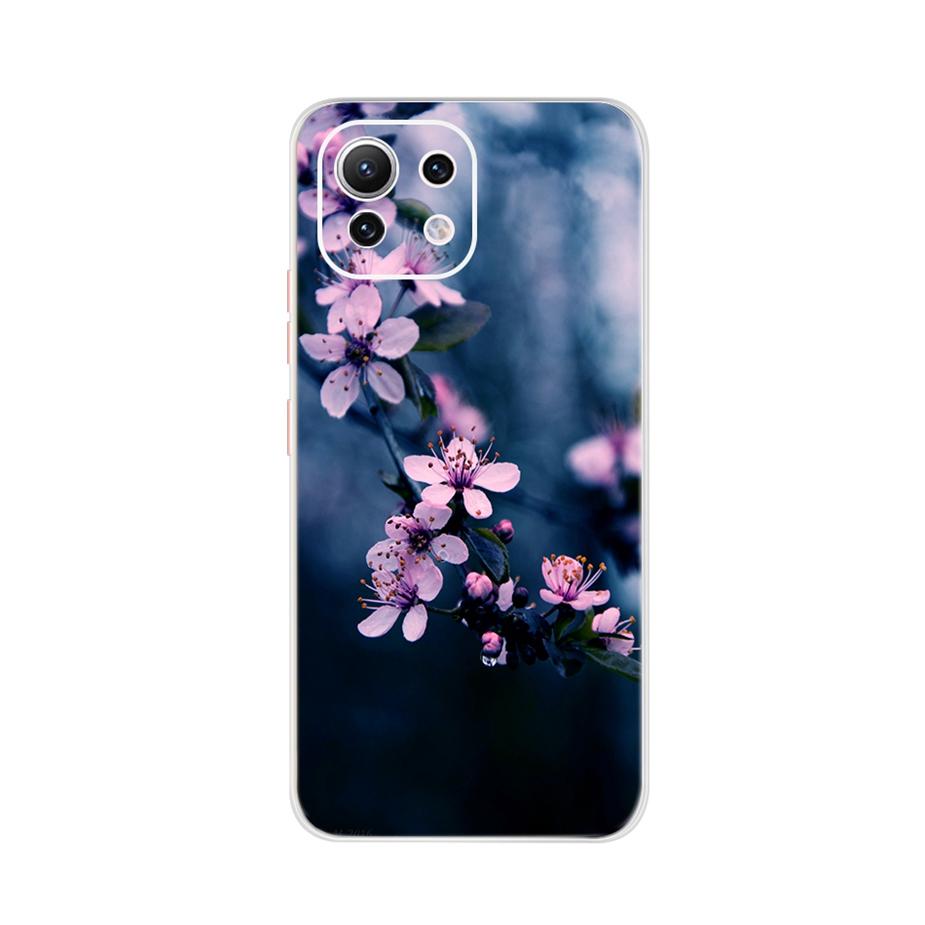 For Xiaomi Mi 11 Lite Case Cute Cartoon Cover For Xiaomi Mi 11 Lite 5G Phone Cases Mi11 Lite 11Lite Soft TPU Fundas Capa 6.55''
