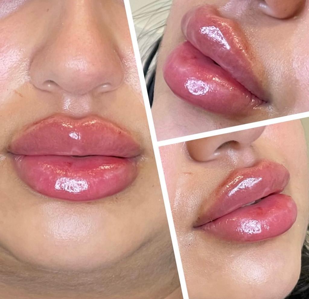 BP Spicule Plump Lip Shot Instantly Volumis Increase Lip Elasticity Long-lasting Moisturize Lip Plumper Gloss Sexy Beauty Makeup