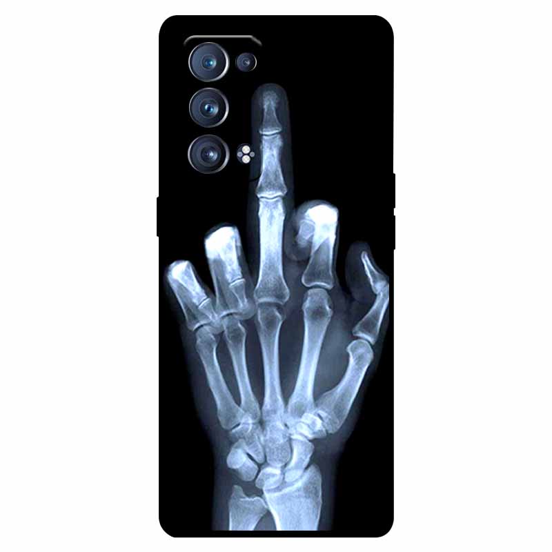 For Oppo Reno 6 Pro 5G Case Snapdragon Shockproof Soft Silicone TPU Back Cover For Oppo Reno 6 Pro CPH2247 Phone Cases Cute Capa