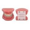 Dental Orthodontic Model 28pcs Teeth Resin Dental Teaching Teeth Model with Metal Braces