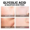 Dual-textured Facial Toning Pads For Exfoliation And Pore Reduction Contains Salicylic Suitable For All Skin Types 1ml 55pads
