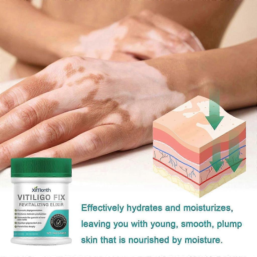 Vitiligo Fix Elixir - Revitalizing Cream for Even Skin Tone & Spot Lightening, 15g!xx2