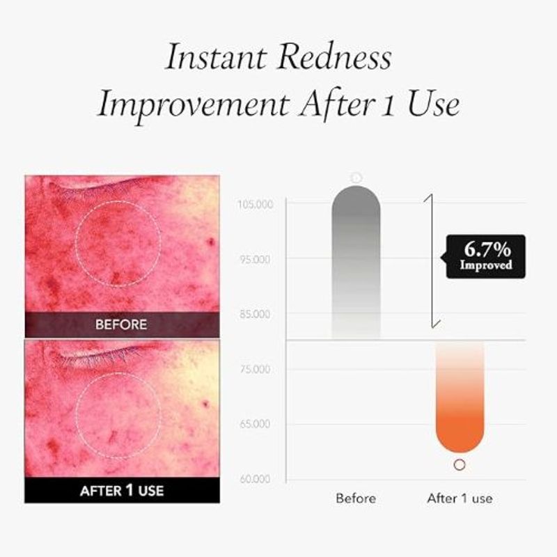 Aprilskin Carrotene IPMP Instant Calming Serum Pads (80ea)