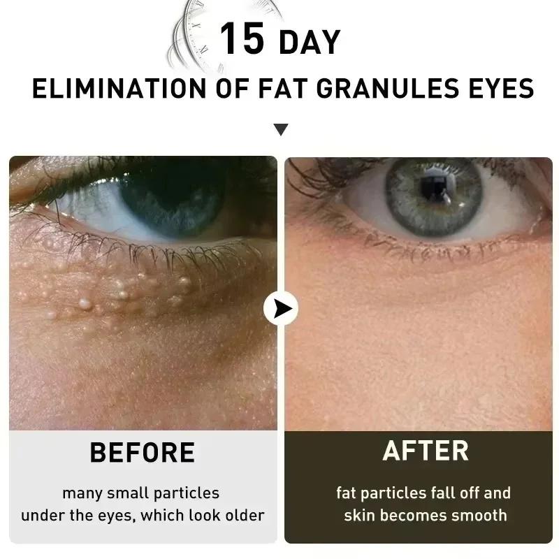 Îndepărtarea Granulelor de Grăsime de sub Ochi Creion de Ochi Cremă Fermitate Anti-Pungi Antiinflamator Estompează Liniile Fine Repararea Barierei Cutanate Îngrijirea Pielii