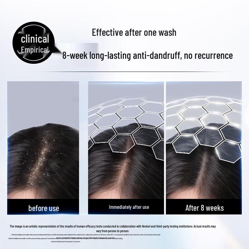 Schwarzkopf Anti-Dandruff Conditioning Shampoo