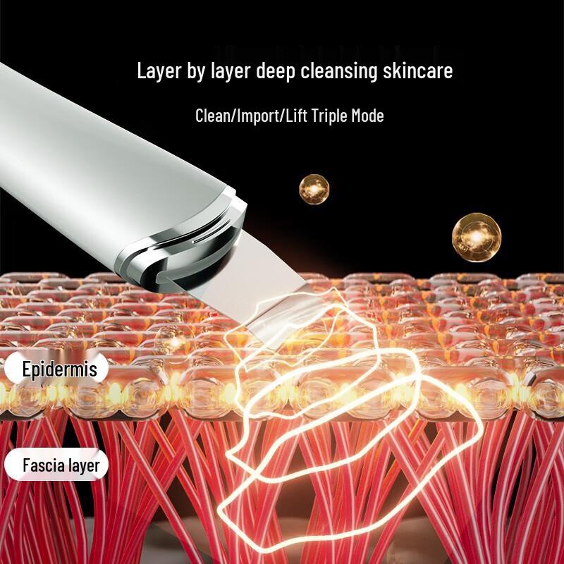 Konka Ultrasonic Skin Scrubber & Blackhead Remover