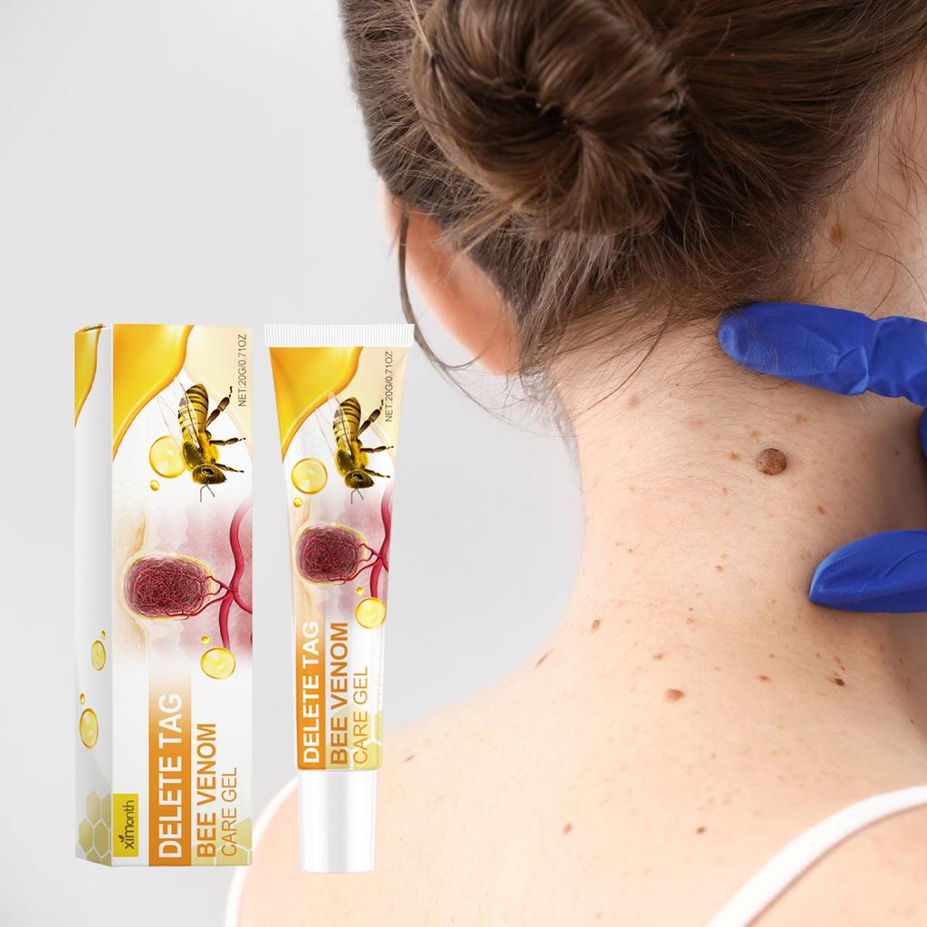 Bee Relief Ointment, Bee  Gel, And Bee  Can Remove Skin Pimples Without Irritation Or Traces,20ML