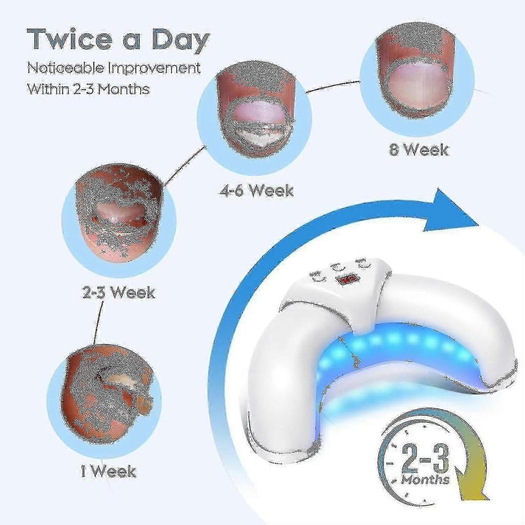 2024 Nail Fungus Laser Treatment Device Compatible with Multiple Toenail, Home Use 905nm Infrared Light + 470nm Blue Light Toe Nail