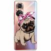 Clear Soft TPU Cover For Honor 50 Pro Lite Case Honor70 5G New Silicone Transparent Funda for Huawei Honor 70 5G Honor50 Coque