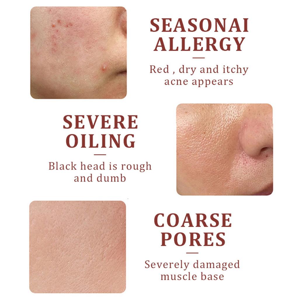 Calendula Serum Moisturizing And Nourishing Gently Repairs The Skin To Fade And Refine The Serum 50ml