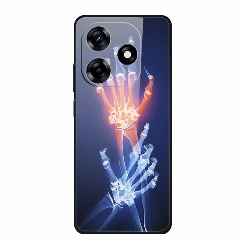 Glass Back Cover For Honor X5c / X5c Plus 4G Case Hard Tempered Glass Cases For Honor Play 10A 2025 Case Protective Funda Para