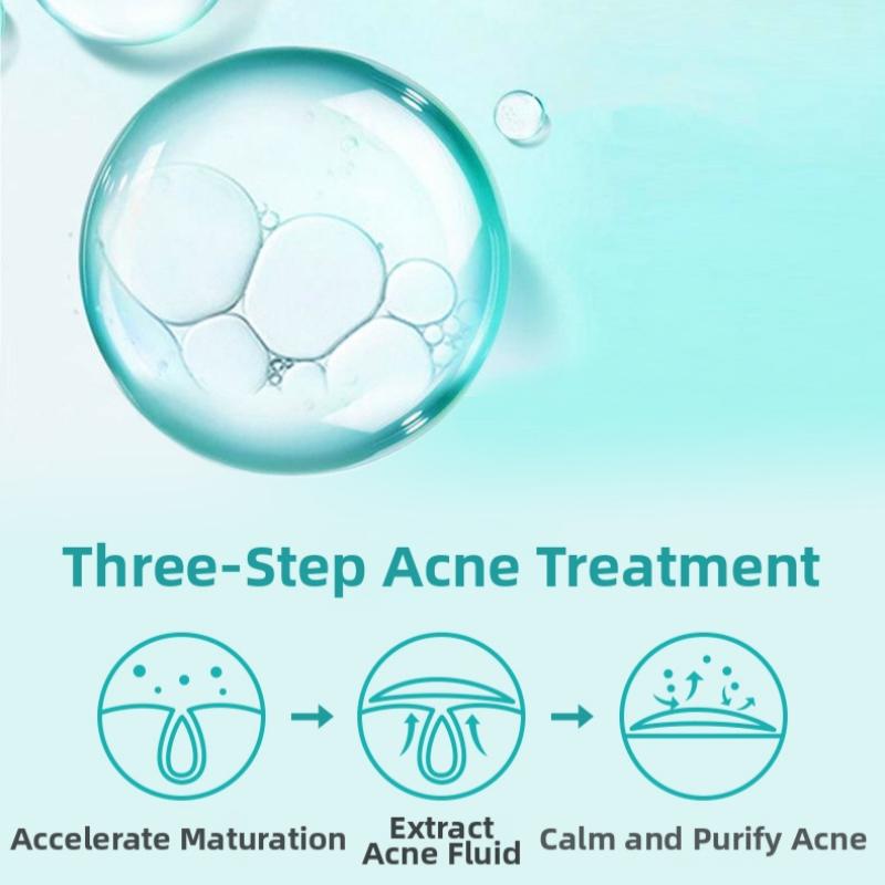 200 Patches / Pack Star Shape Hydrocolloid Acne Pimple Patch 5 Color Acne Concealer Sticker for Blemishes and Zits Cover