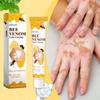 Krém na péči o vitiligo s včelím jedem Včelí jed Opravný a hydratační krém na péči o pleť Pro vnější použití