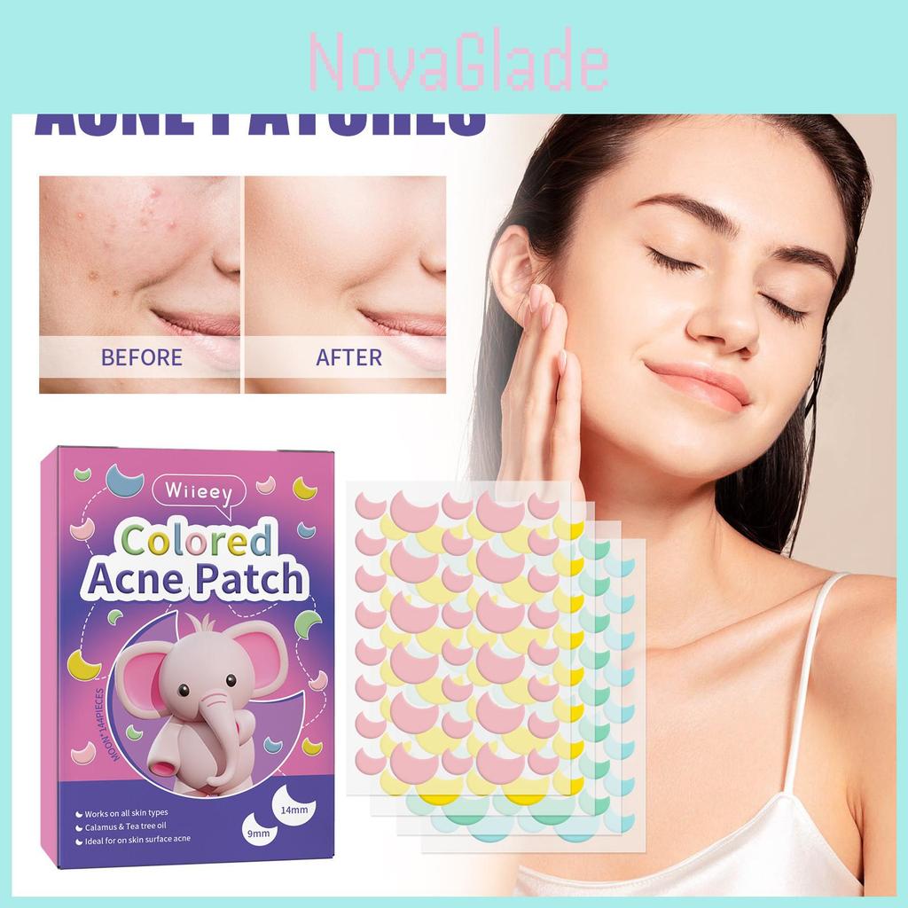Wiieey Moon Pimple Patches For Diminishing Acne Marks And Concealing Blemishes 144pcs