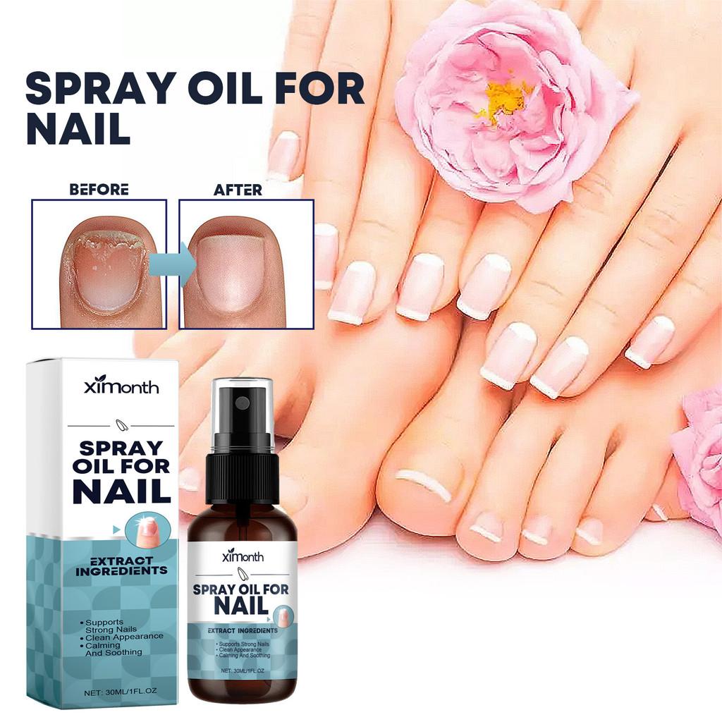 Ximonth Nail Care Spray Nourishing Moisturizing Solution For Strong Healthy Nails 30ml