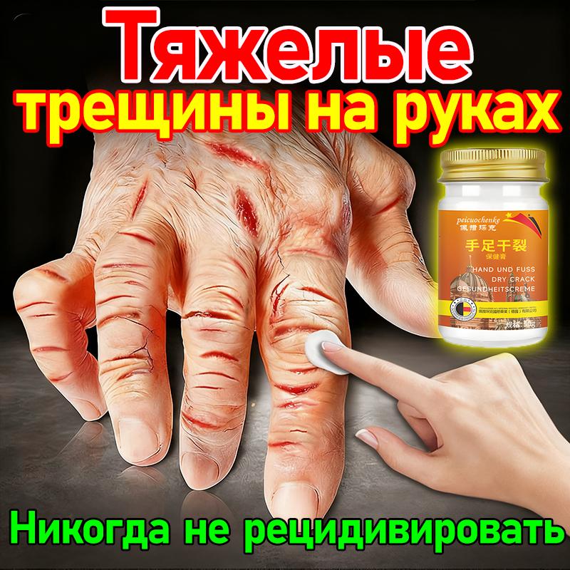 

Repairing Ointment for Fungal Infection, Peeling, and Cracked Hands & Feet