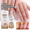 OUHOE 7-Day Nail Repair Essence Liquid for Hands and Feet, Brightening, Softening, and Thickening Nail Care Liquid for Toenails
