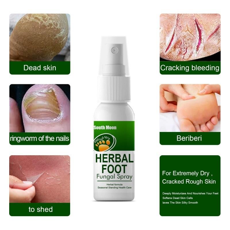 South Moon Herbal Foot Spray For Itchy Feet With Odor Removal And Skin Care 30ml