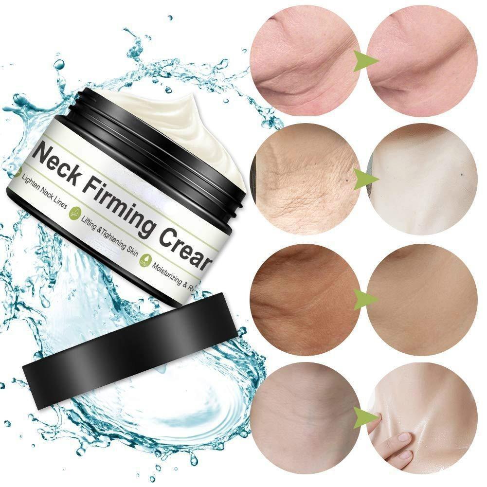 Crema para el cuello,Crema hidratante para el cuello,Crema antiarrugas y antienvejecimiento para el cuello, escote, papada, pavo, flacidez del cuello, crepé