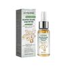 Revitalize Hair Growth Serum with Ginger & Plant Extracts  Nourishing Scalp Treatment for Thicker, Stronger Hair, Reduces Hair Loss & Promotes Natural