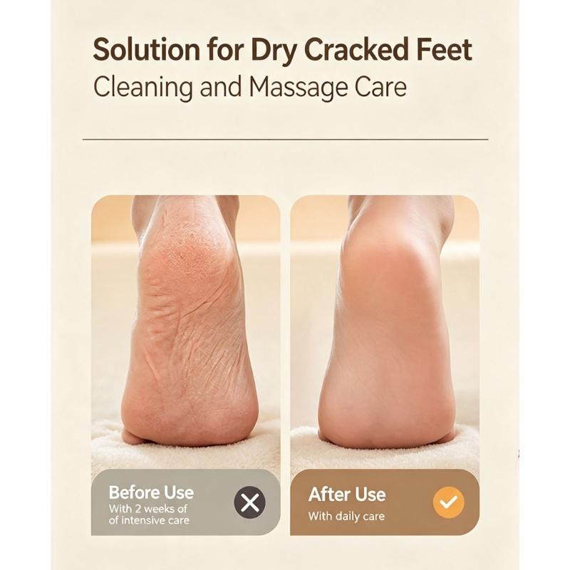 Type-C Rechargeable Electric Foot File with Two Grinding Heads, Heel Care Tool for Dead Skin and Daily Pedicure Use