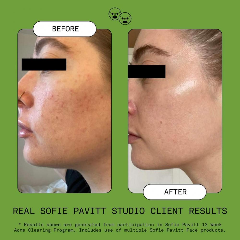 Sofie Pavitt Face Gentle Gel Foaming Cleanser 3.8 Oz   109 Ml