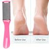 Portable Manicure Pedicure Nail Care Kit, 5Pcs Nail Clipper Foot File Cuticle Pusher Toe Separators with Bag