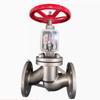 Stainless Steel Oxygen Globe Valve