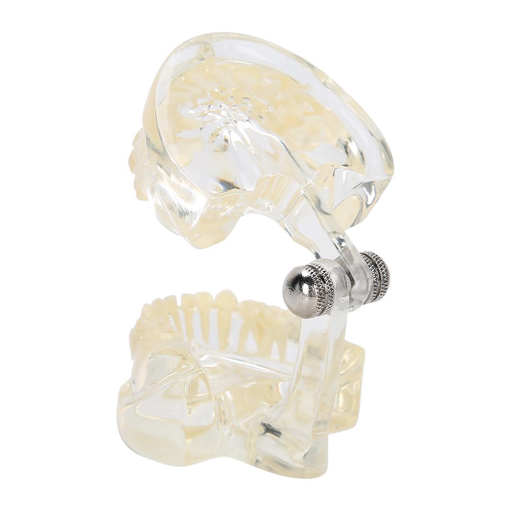 Dental Deciduous Teeth Model Removable Teeth Model Teaching Tool for Dentist