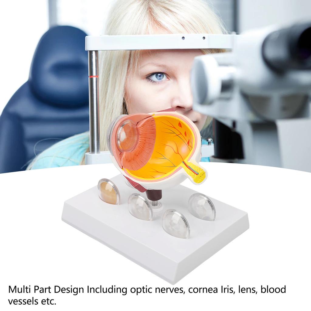 Eyeball Lesion Model Enlarged Human Eye Anatomical Model Accurate Shows Optic  Cornea  Lens  Eyeball Model