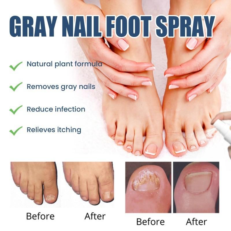 South Moon Gray Nail Repair Spray Nourishing Moisturizing Treatment For Dry And Odorous Nails