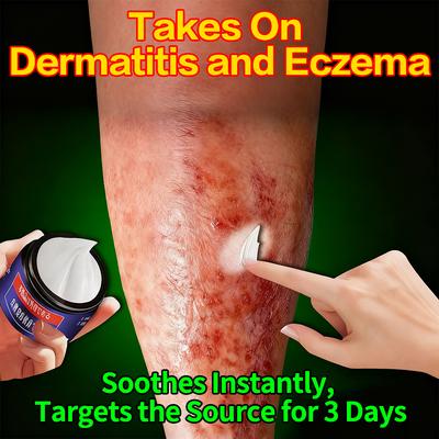 Medicated Cream for Skin Problems