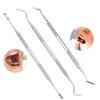 Dental Teeth Whitening Kit Dentist Tooth Plaque Calculus Tartar Remover Tool Set