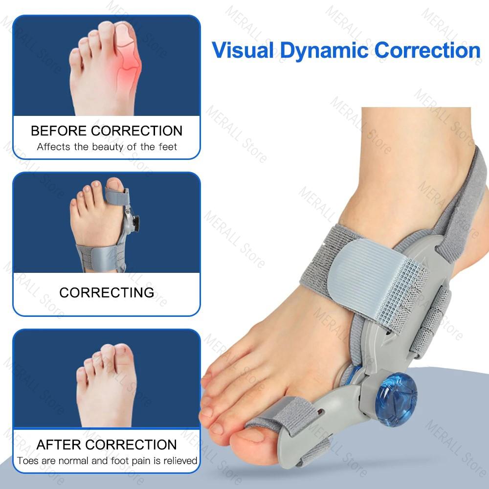 Adjustable Hallux Valgus Big Toe Corrector Orthopedic Bunion Corrector Device Foot Pain Relief Splint Toe Orthopedic Supplies
