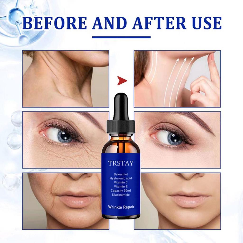 5G/15G/30G/50G/TRSTAY Kollagen Anti-falten Creme Retinol gesicht creme Feuchtigkeitsspendende Creme Haut Weichmachende gesicht creme