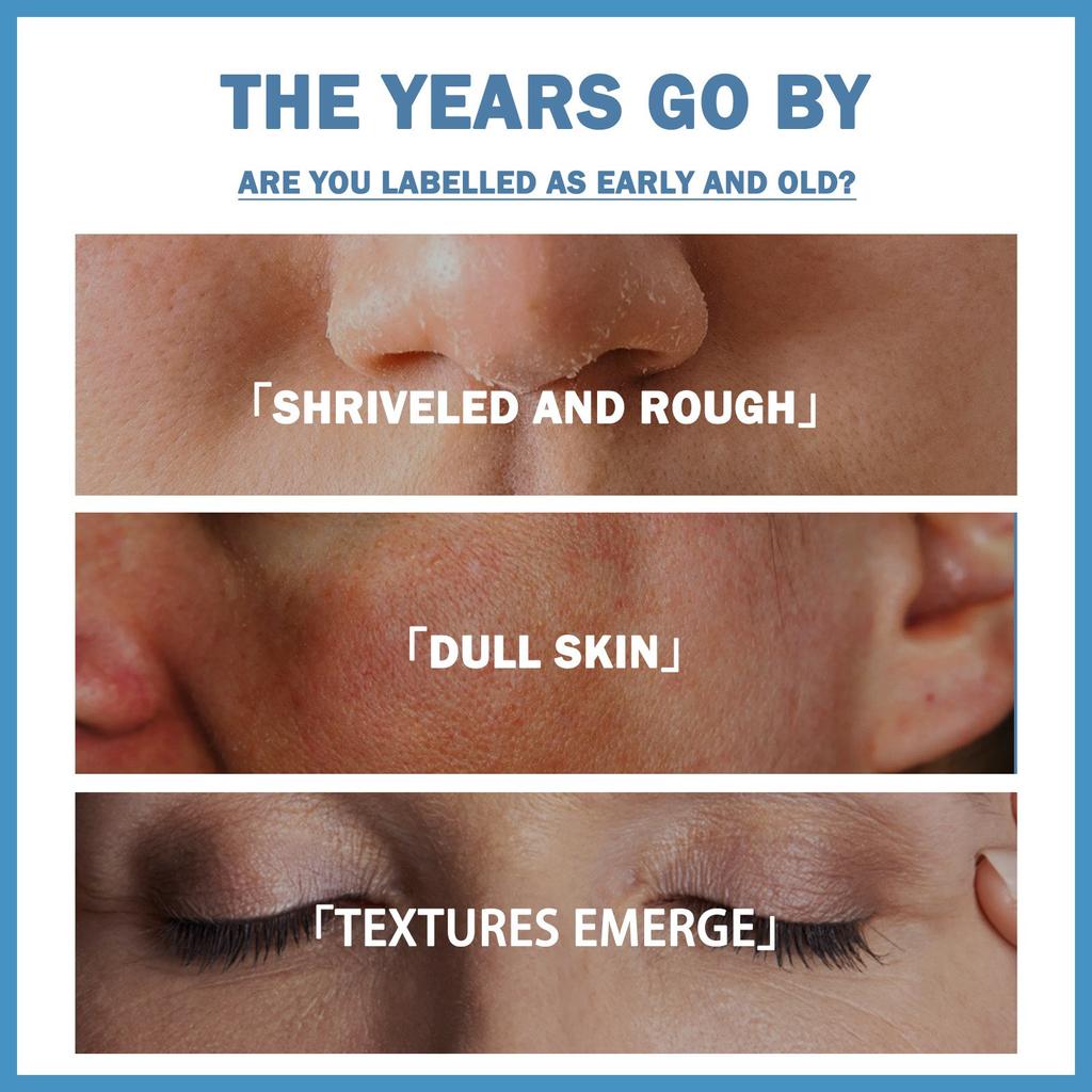 Niacinamide Serum Reduce Fine Lines, Nourishing And Moisturizing Care. Dull Skin, Whitening Aging Serum, Moisturizing And Wrinkle Serum,30ML/1.8 Floz