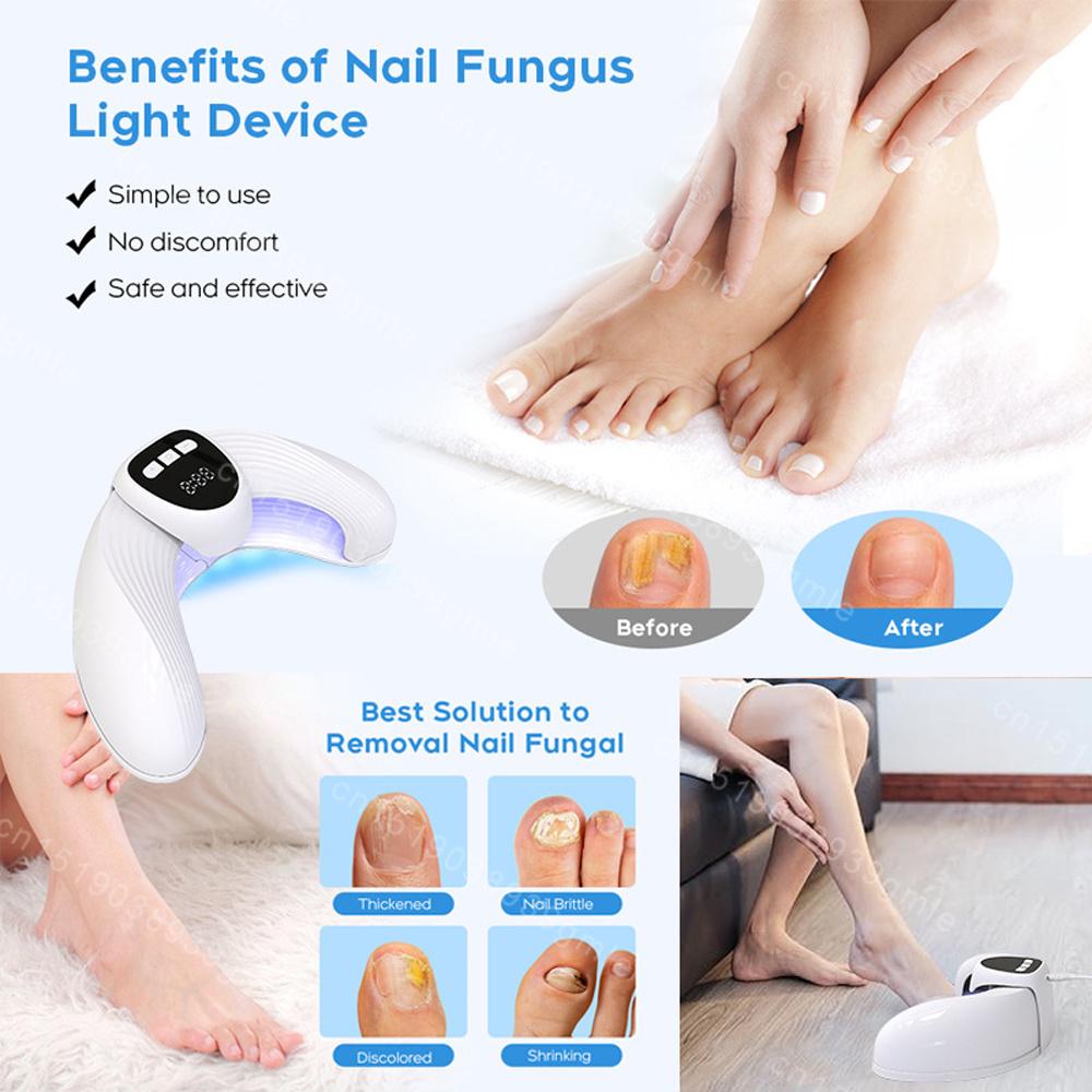 Fungus Treatments Instrument Nail Fungus Laser Device Anti Infection Cure Machine Toenails Paronychia Onychomycosis Care