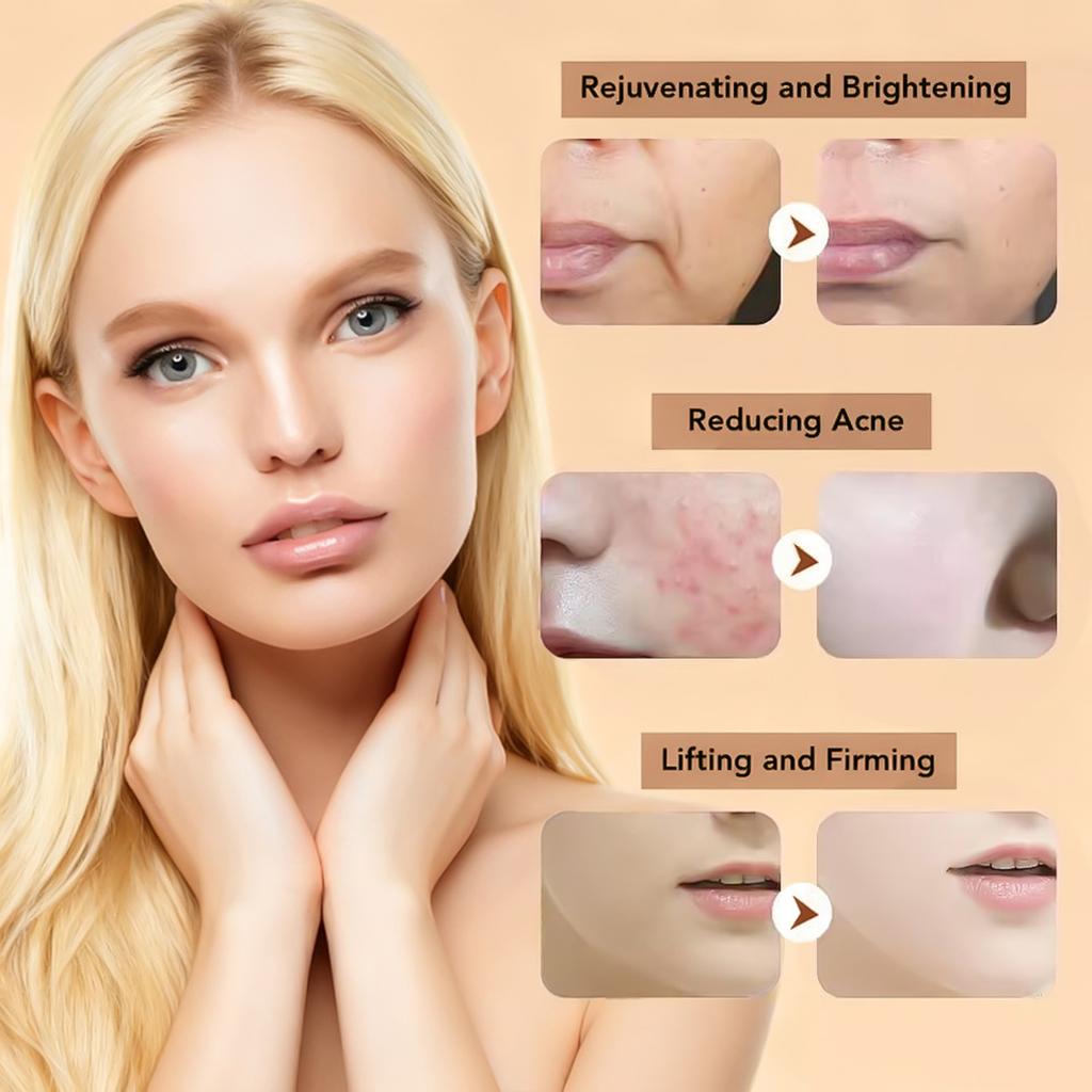 High-quality Blackhead Remover Made Of Stainless Steel