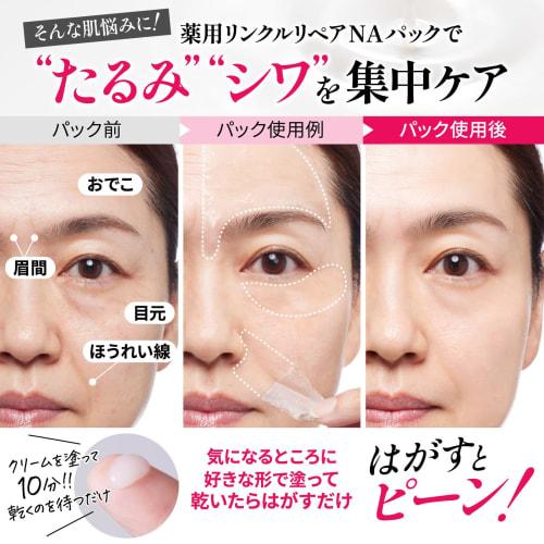 Medicated wrinkle improvement pack nasolabial folds glabellar wrinkles forehead sagging niacinamide retinol wrinkle repair na 30g