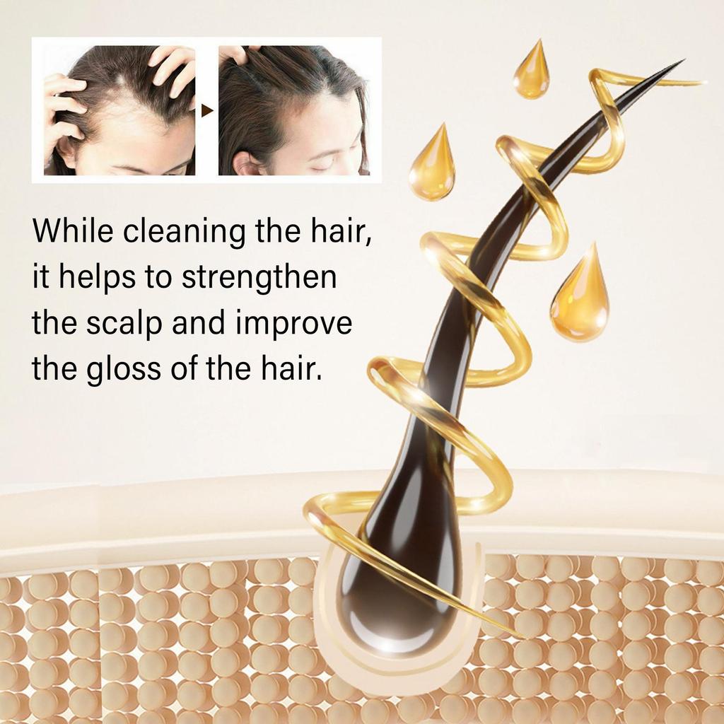 Hoegoa Onion Biotin Shampoo (With Rosemary Extract) 200ml, Anti-Hair Loss, Scalp Care, Promotes Hair Growth, Strengthens & Thickens Hair