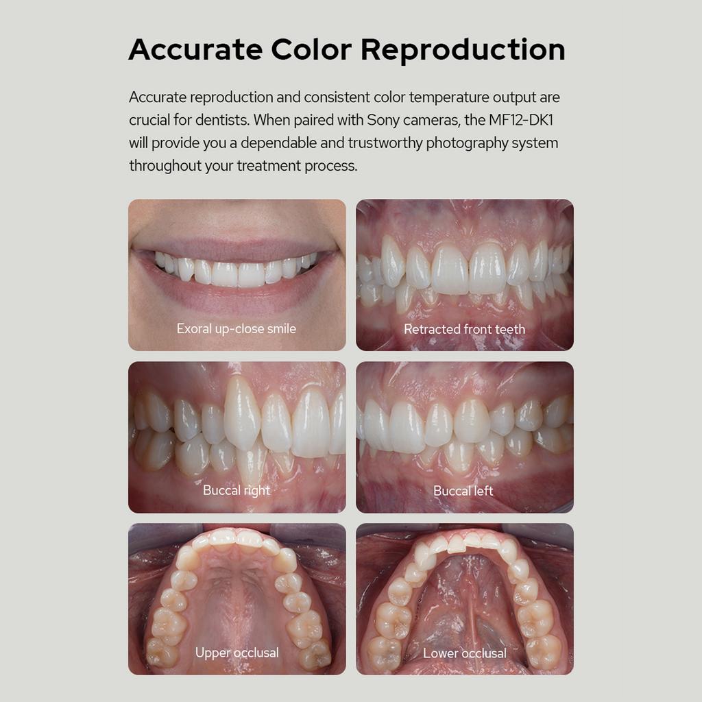Kit bliț macro GODOX MF12-DK1, care include 2 x MF12 lumini TTL în afara camerei + 1 x declanșator Flsh + 8