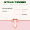 WEST MONTH Hydrocolloid Acne Patches, Invisible Makeup Patches, Waterproof Breathable, Gentle Lightweight Pimple Patches for Face, 36 Count