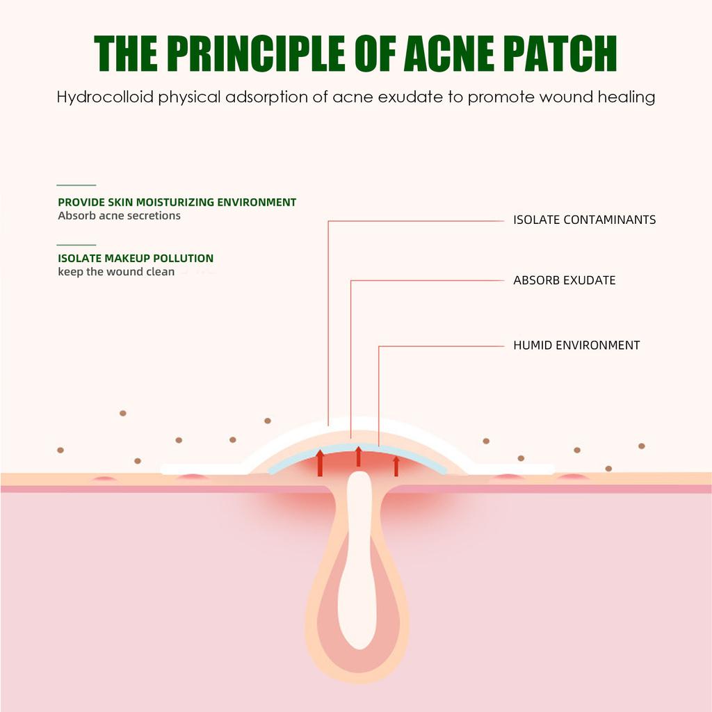 WEST MONTH Hydrocolloid Acne Patches, Invisible Makeup Patches, Waterproof Breathable, Gentle Lightweight Pimple Patches for Face, 36 Count
