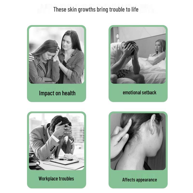 Юлин Оригинальная Тайская Травяная Местная Мазь