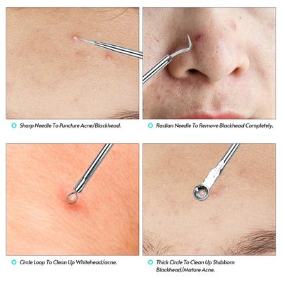Set de instrumente pentru îndepărtarea punctelor negre Pimple Popper pentru Coșuri Coșuri Comedone Acnee Zit Whitehead Face Chin