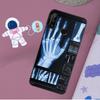 Radiological Human Organs Skeleton For Huawei Nova 12s 12i 11i 8i Y73 Y72 Y61 Y91 Y90 Y70 Y60 9 10 SE P30 P40 Lite P60 Pro Case