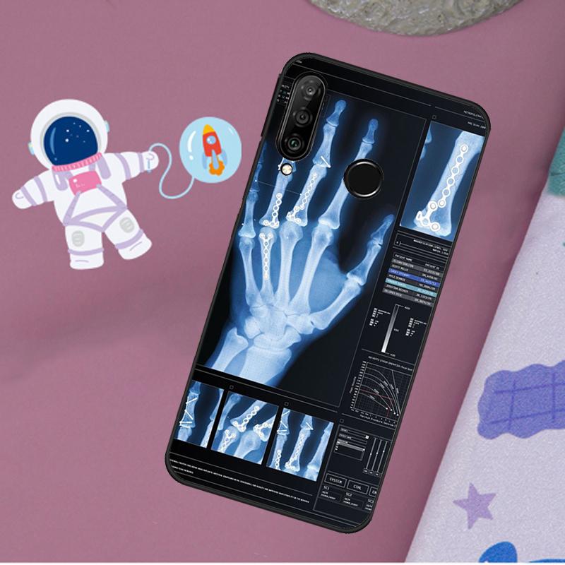 Radiological Human Organs Skeleton For Huawei Nova 12s 12i 11i 8i Y73 Y72 Y61 Y91 Y90 Y70 Y60 9 10 SE P30 P40 Lite P60 Pro Case
