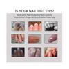 3x Efero Nagelpeeling Pflanzen-Nagelreparatur-Flüssigkeit Nagelcreme Nagelpflege-Gel Nagelreparatur-Gel Feuchtigkeitsspendender Nagelglanz Tw