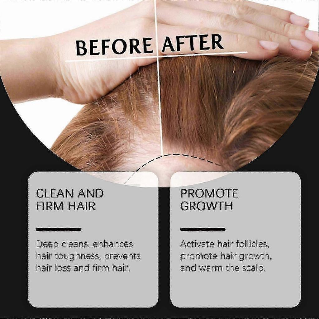 Hoegoa Rice Shampoo for Scalp Cleaning, Nourishing Hair, Repairing Hair Follicles, Smooth Hair Hair Shampoo